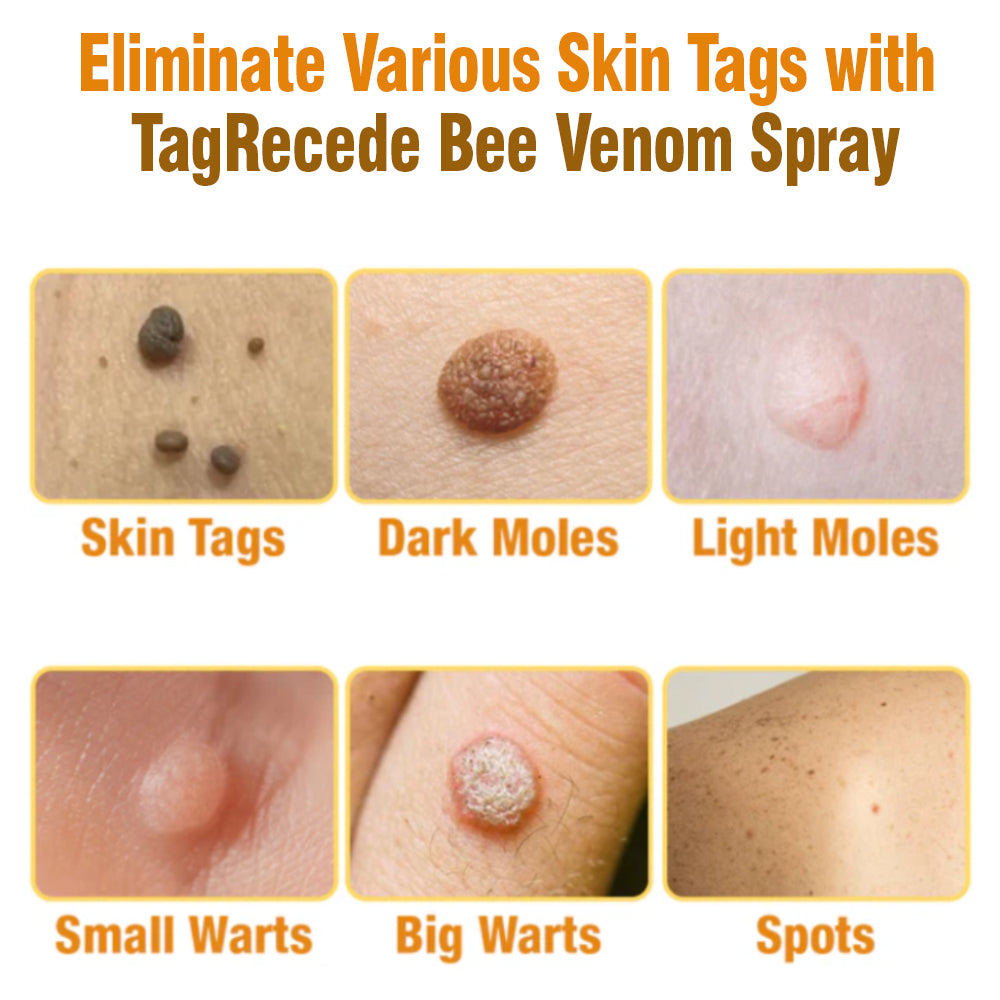 flysmus™ Tag Recede Bee Venom Treatment Spray